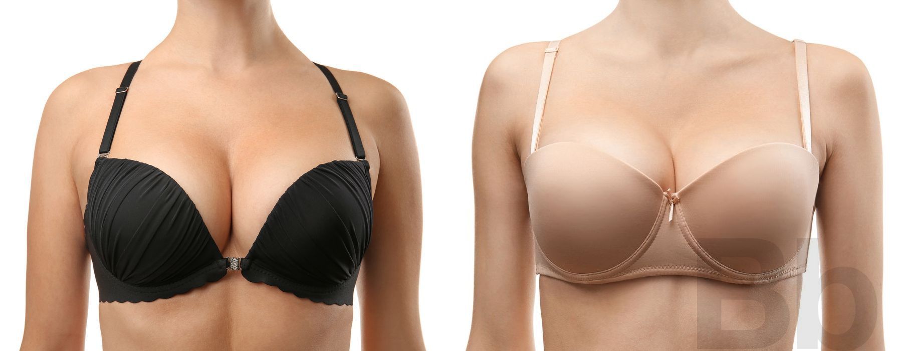 Breast Augmentation - Thumbnail 2