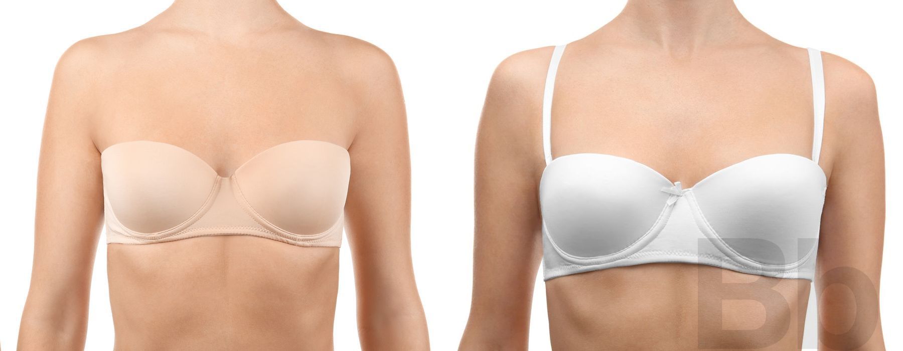 Breast Augmentation - Case 59