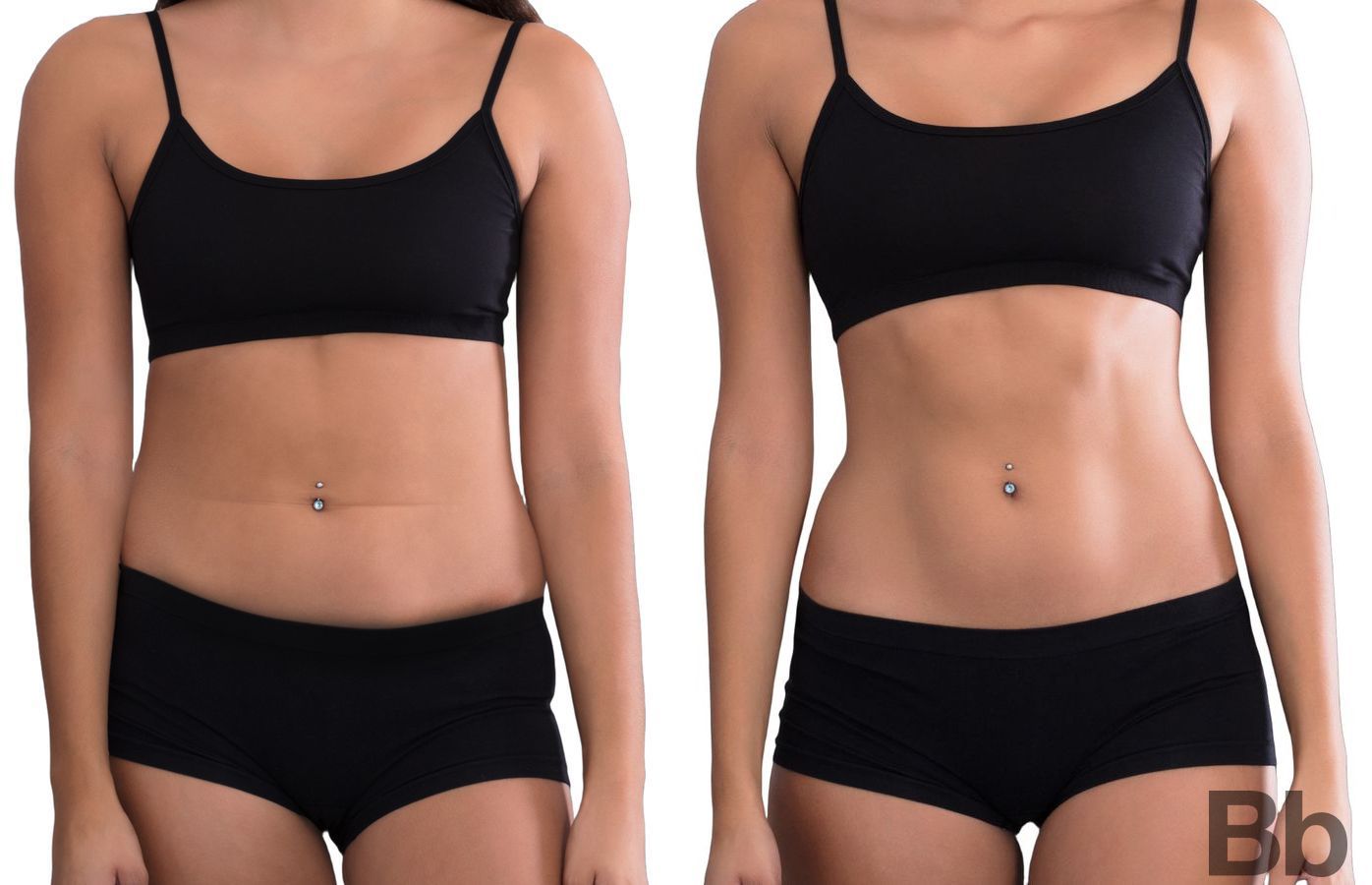 Before and after Liposuction case 43119