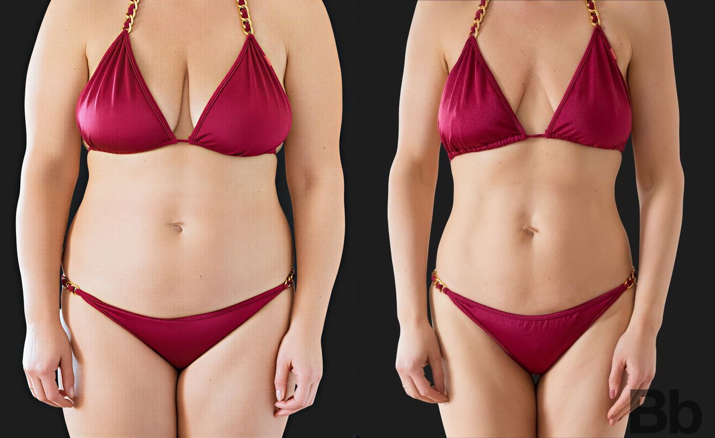 Before and after Liposuction case 23890