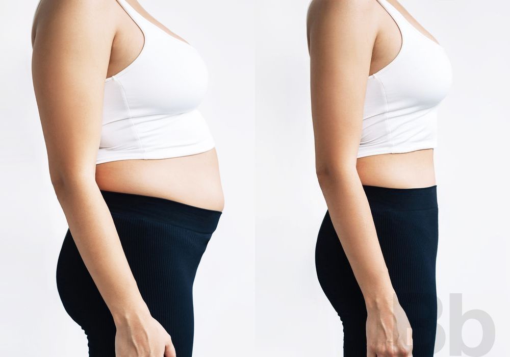 Liposuction - Thumbnail 2