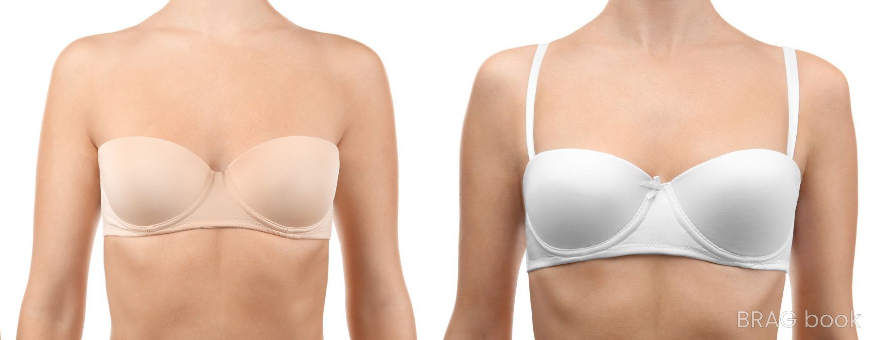 Before and after Breast Augmentation case 10984