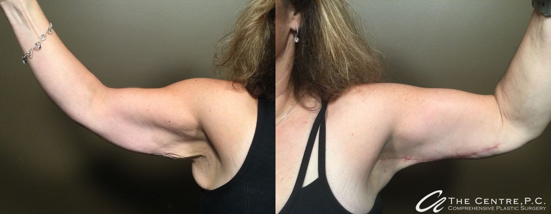 Before and after Featured Cases case 9958