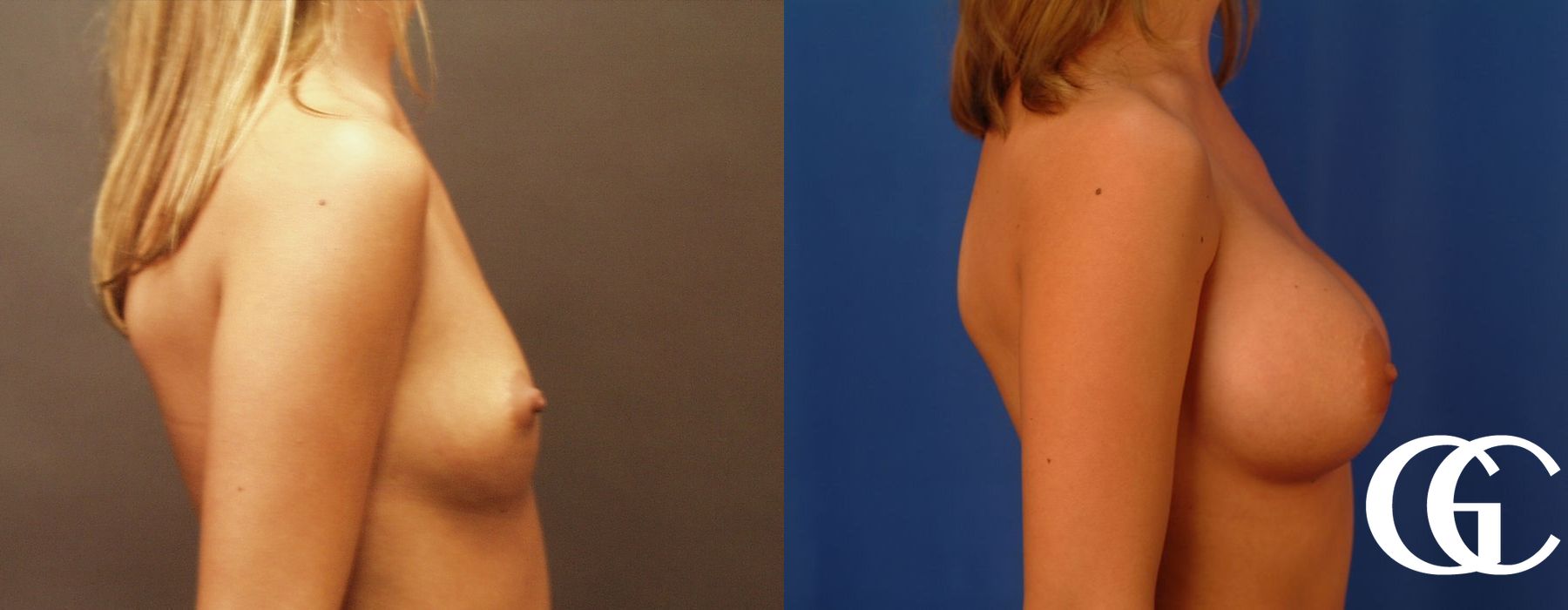 Before photo - Angle 3