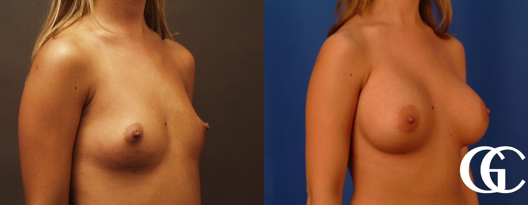 Before photo - Angle 4