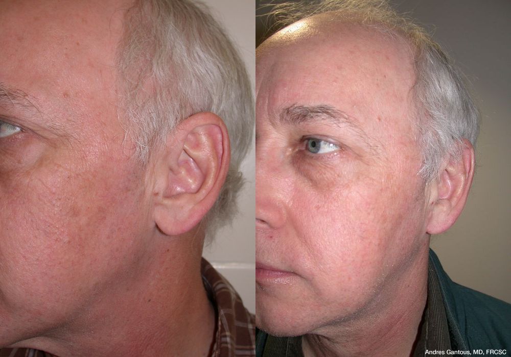 Before photo - Angle 4