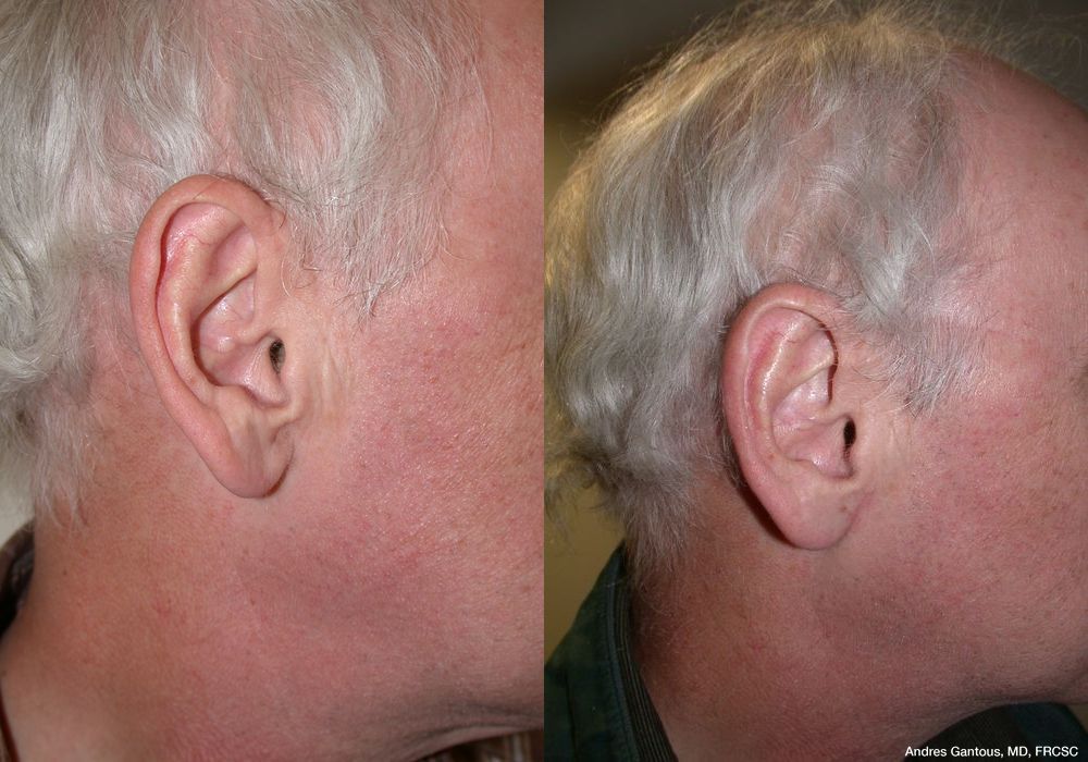 Before photo - Angle 3