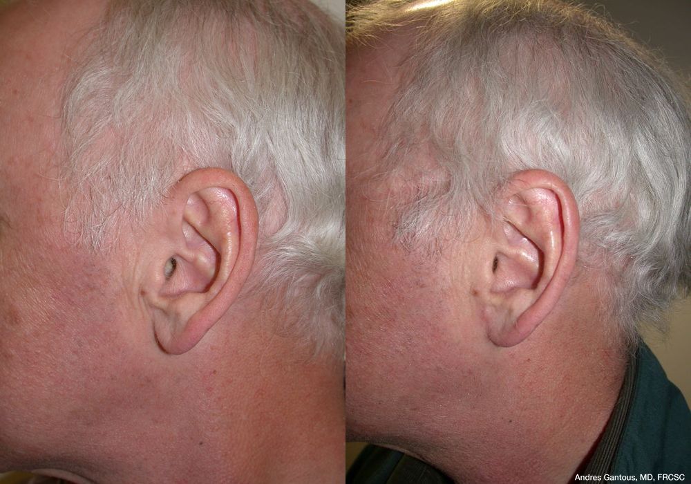 Before photo - Angle 5