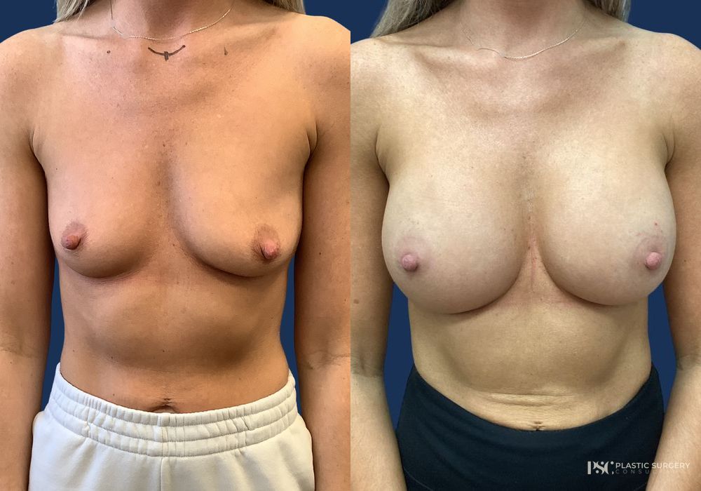 Before and after Dr. Richard J. Wassermann case 26245