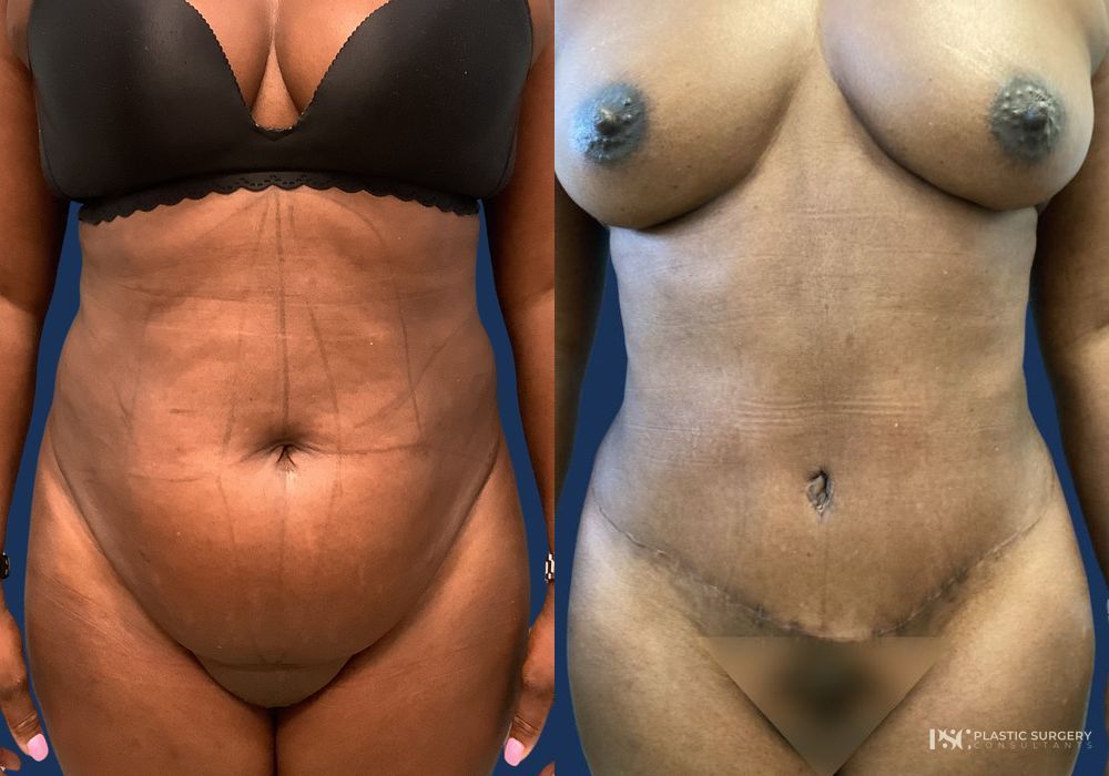Before and after Dr. Richard J. Wassermann case 26248