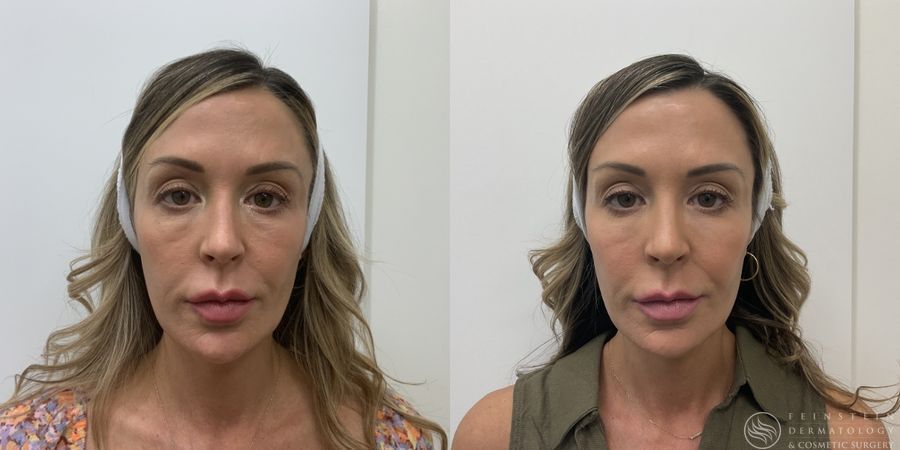 Skinvive - Case 12308