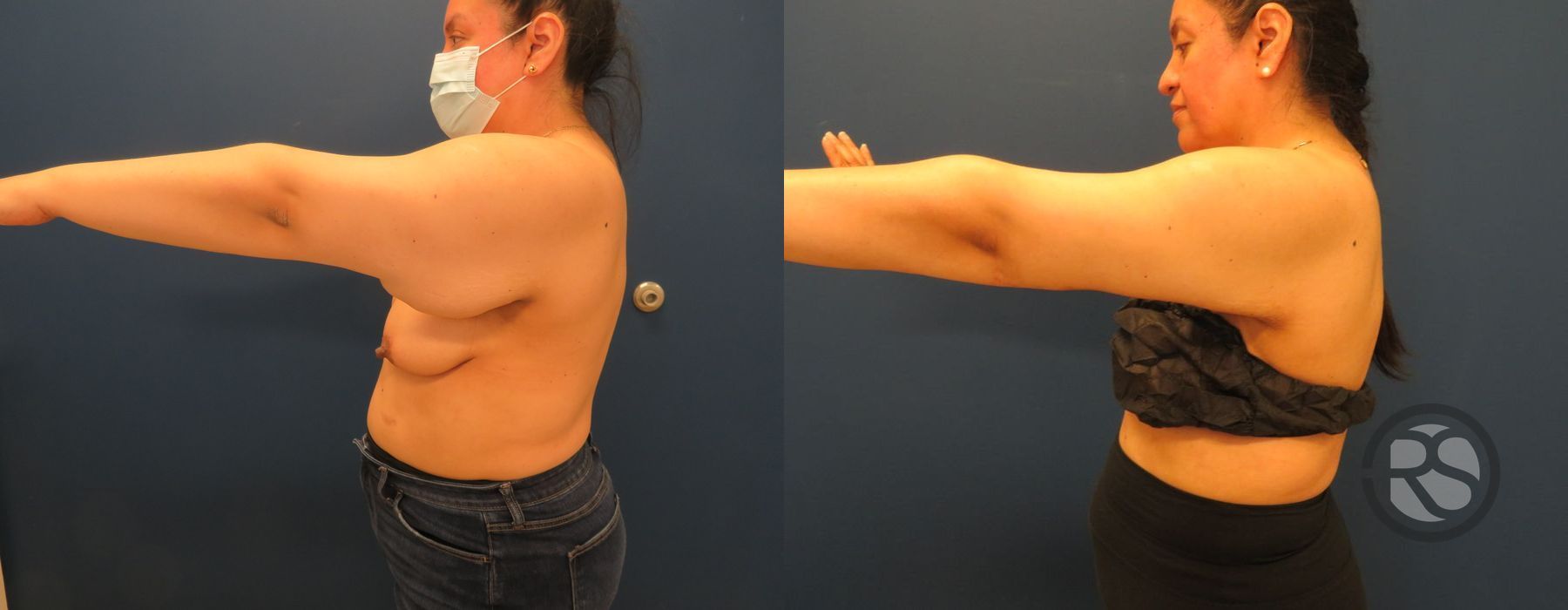 Before photo - Angle 3