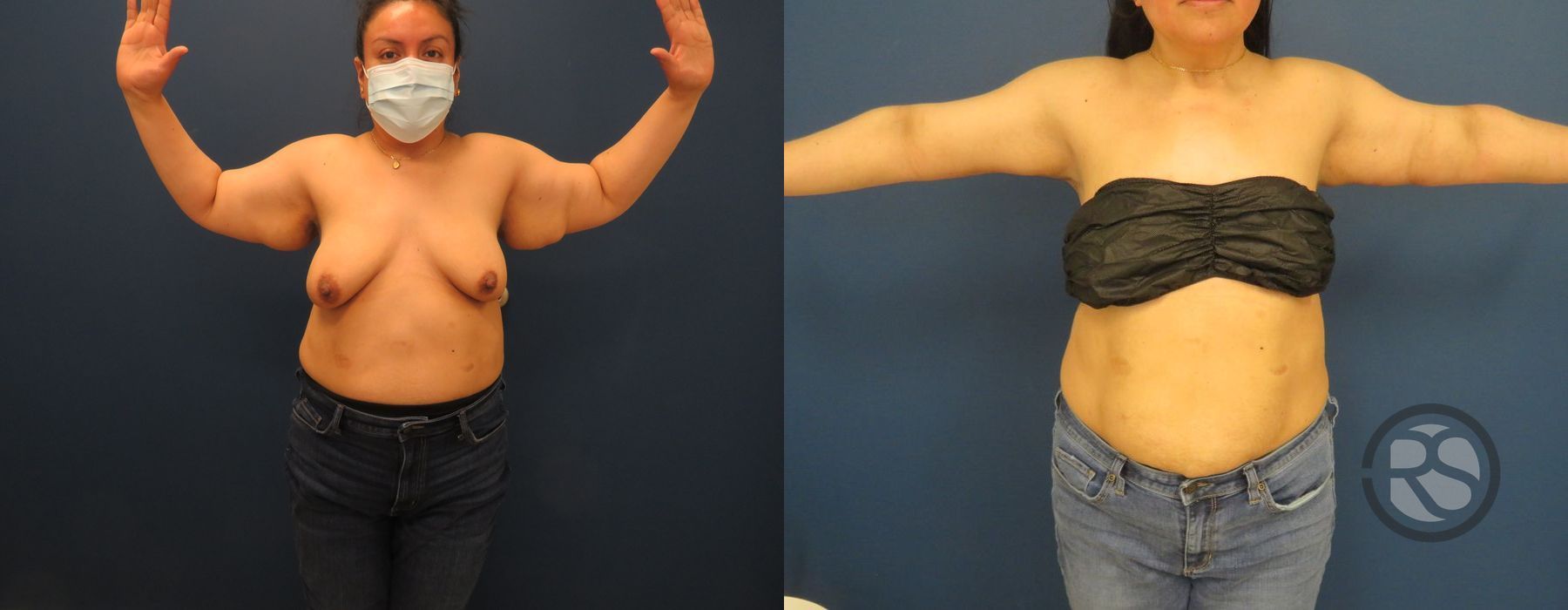 Before photo - Angle 2