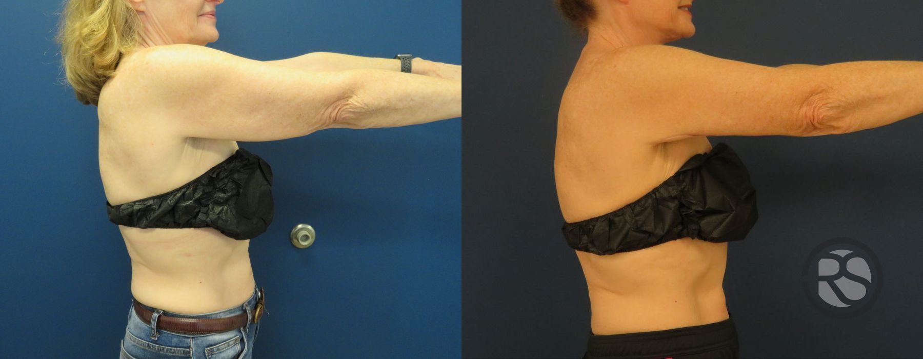 Before photo - Angle 3