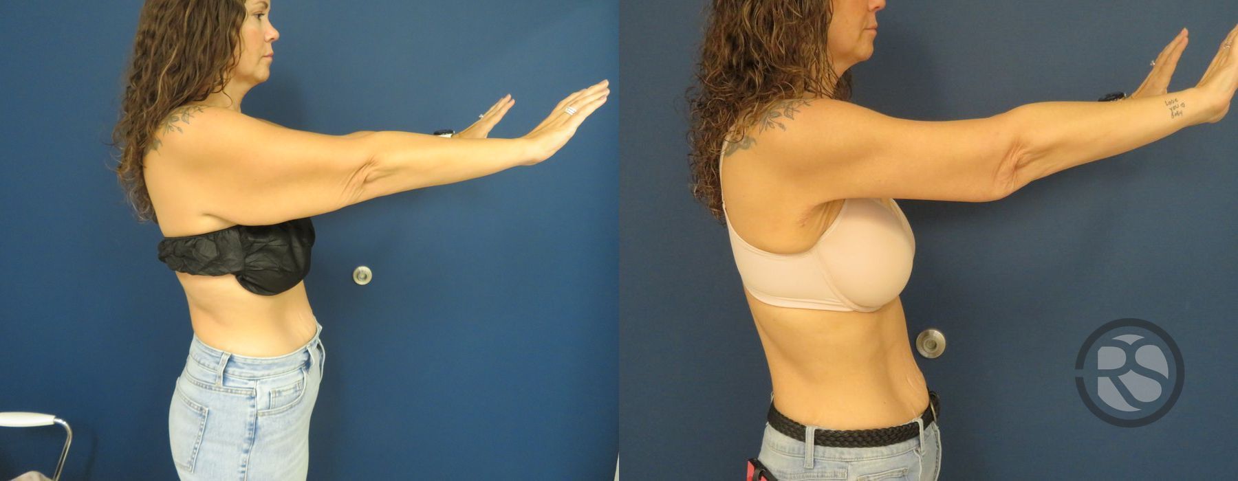 Before photo - Angle 4