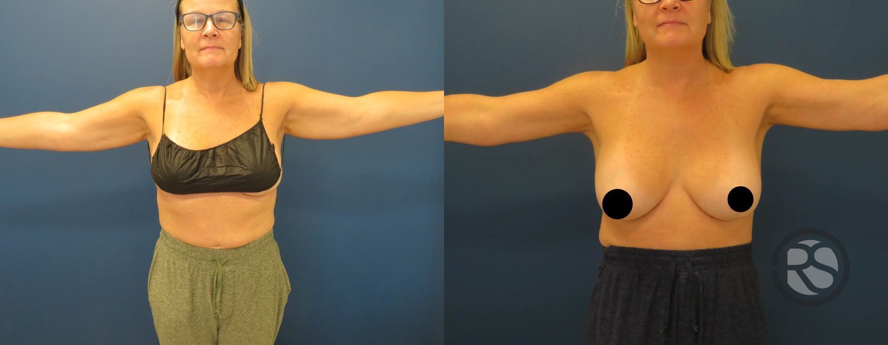 Before photo - Angle 2