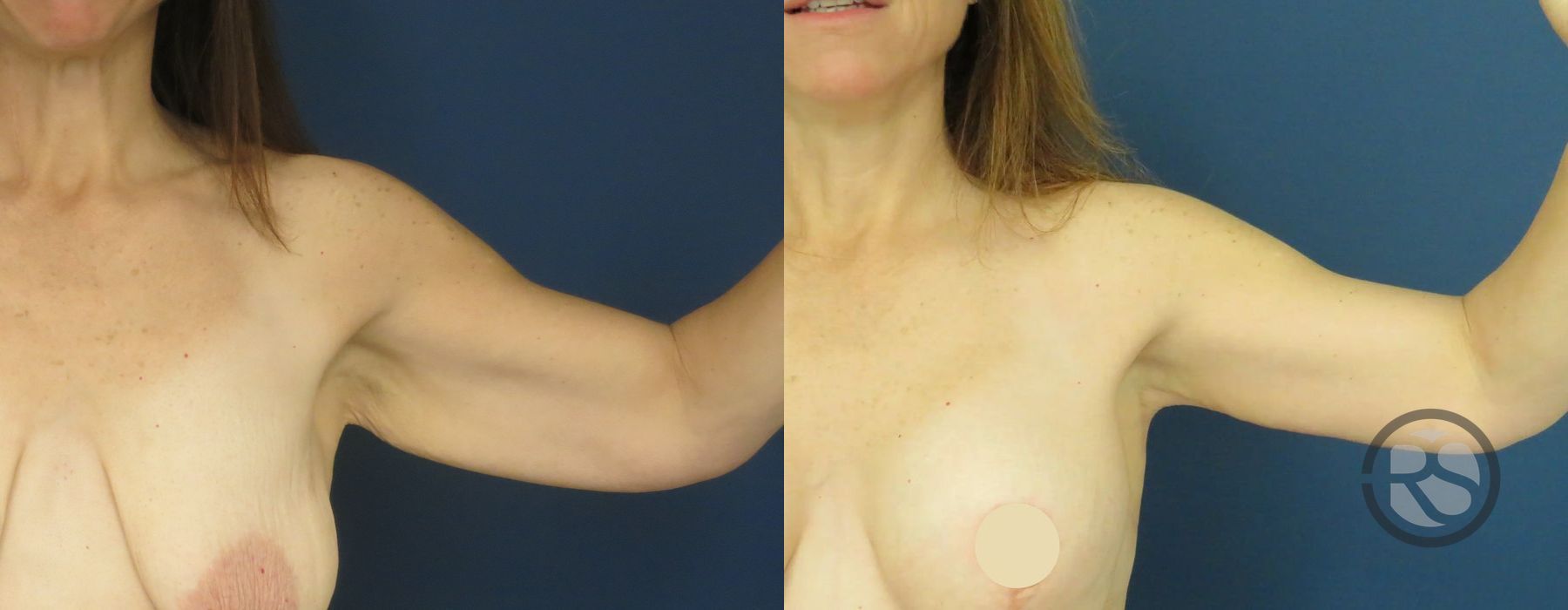 Before photo - Angle 2