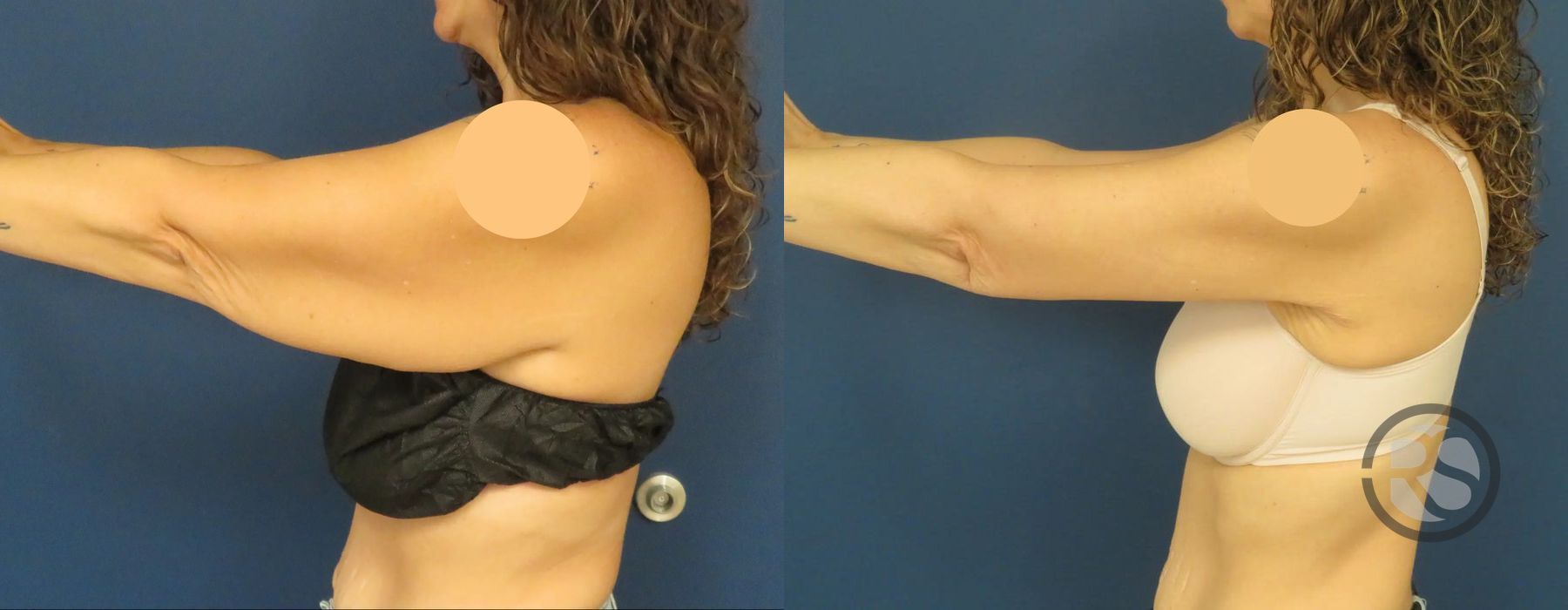 Before photo - Angle 3