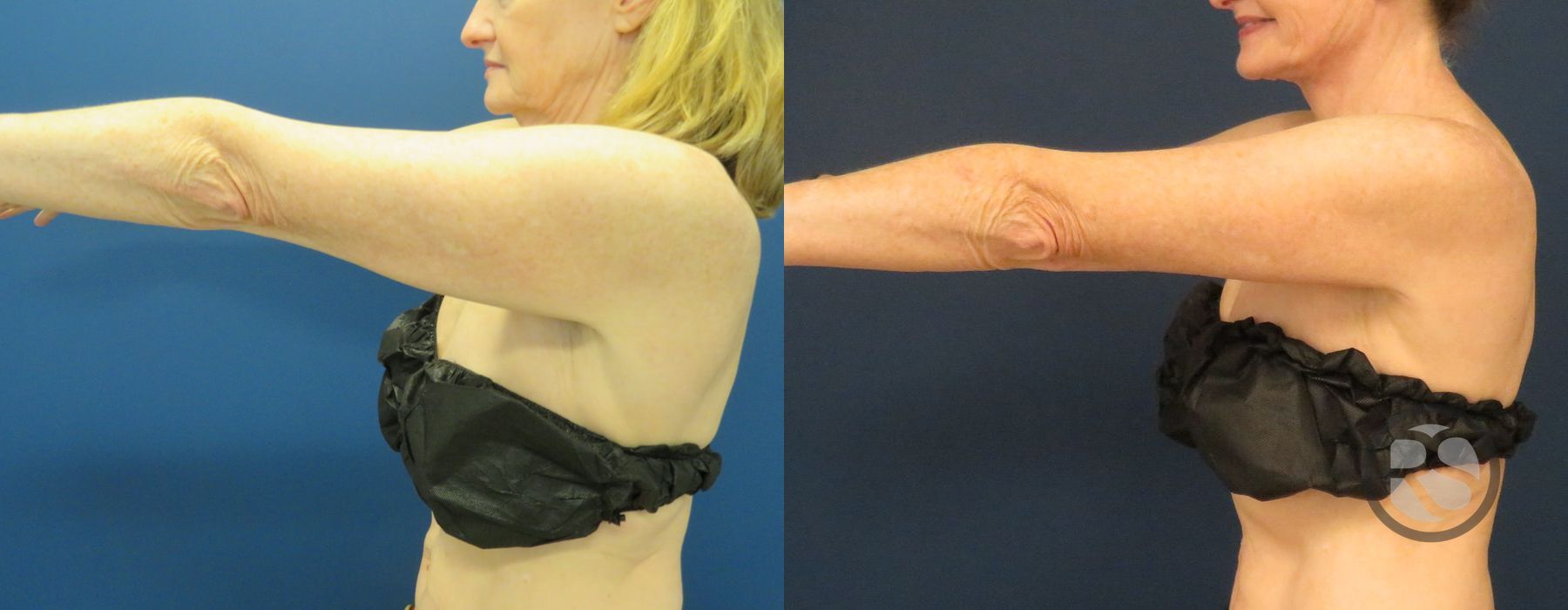 Before photo - Angle 4