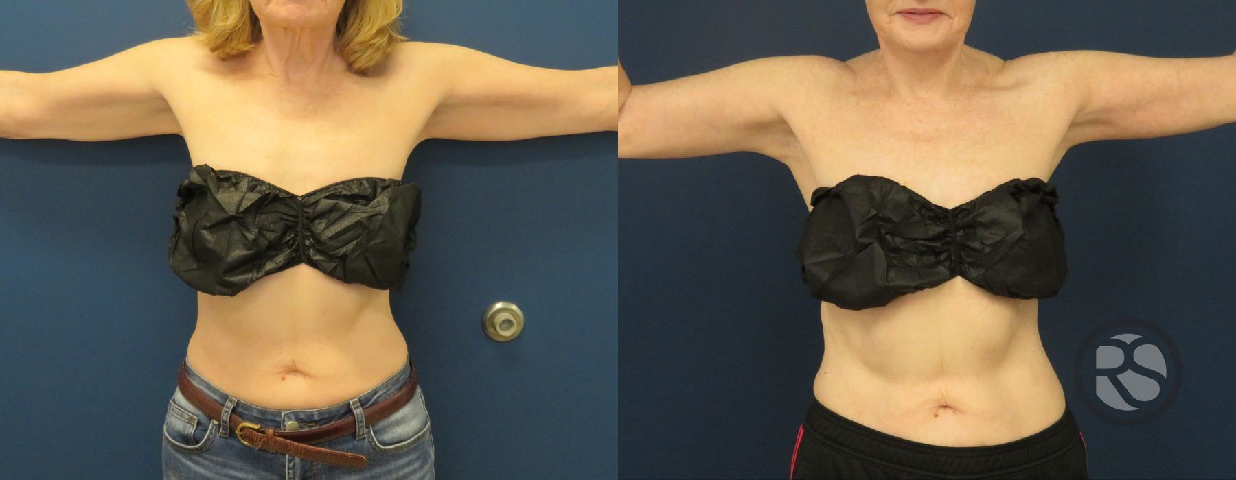 Before photo - Angle 2