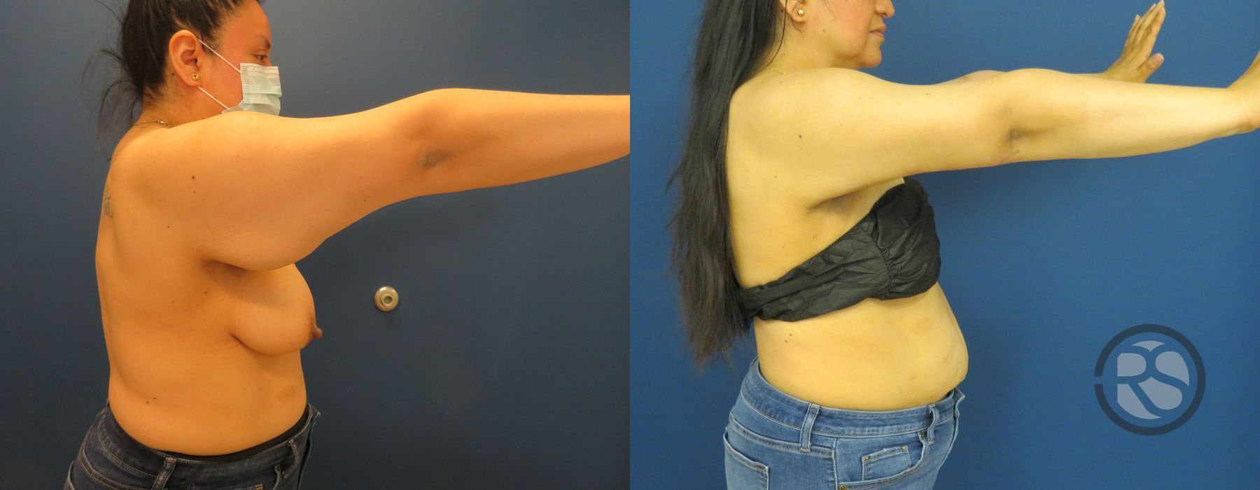 Before photo - Angle 4