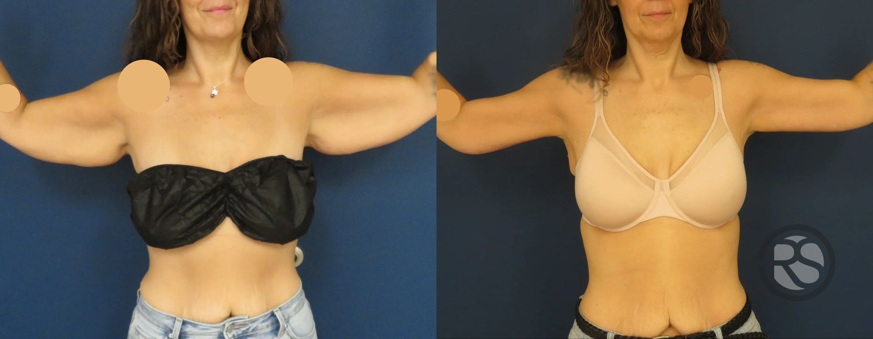 Before photo - Angle 2