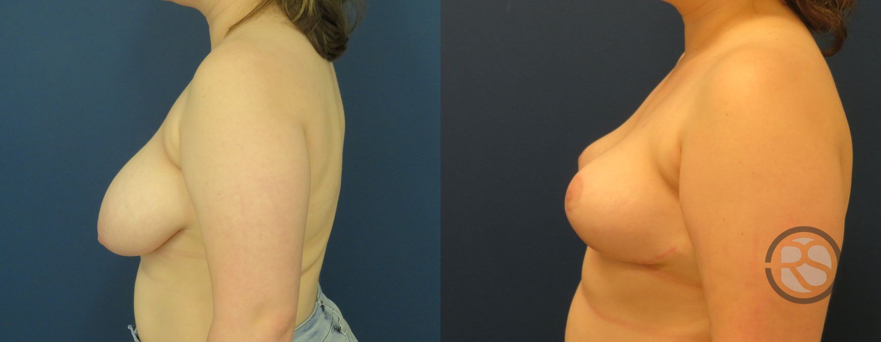 Before photo - Angle 5