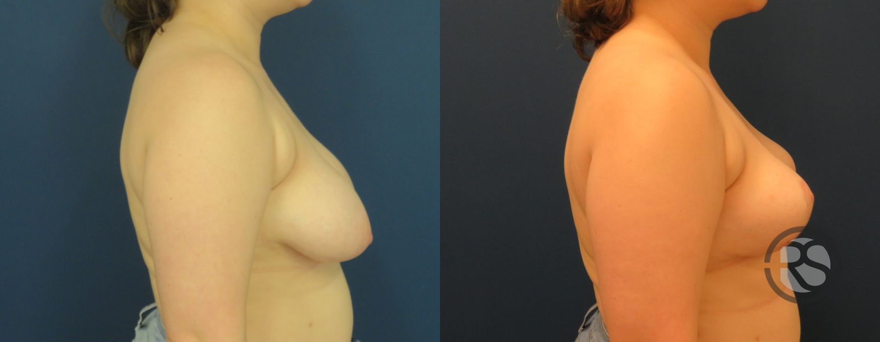 Before photo - Angle 3