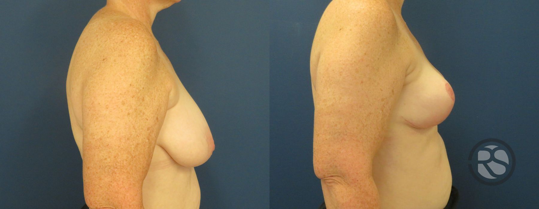 Before photo - Angle 3