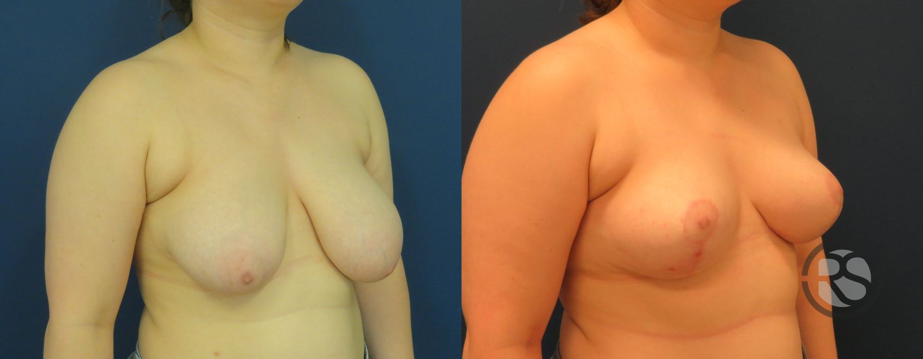 Before photo - Angle 2