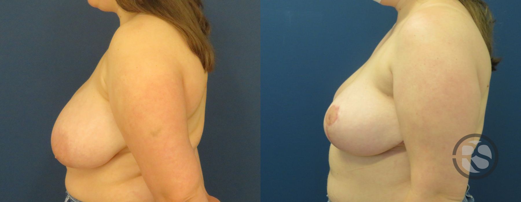 Before photo - Angle 5