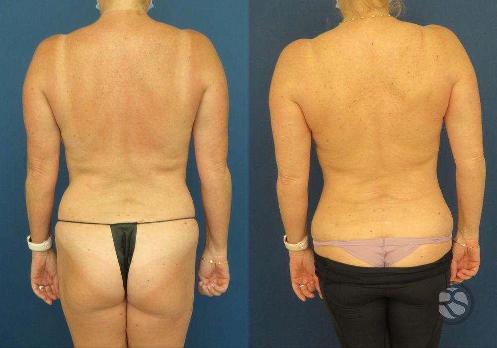 Before photo - Angle 6