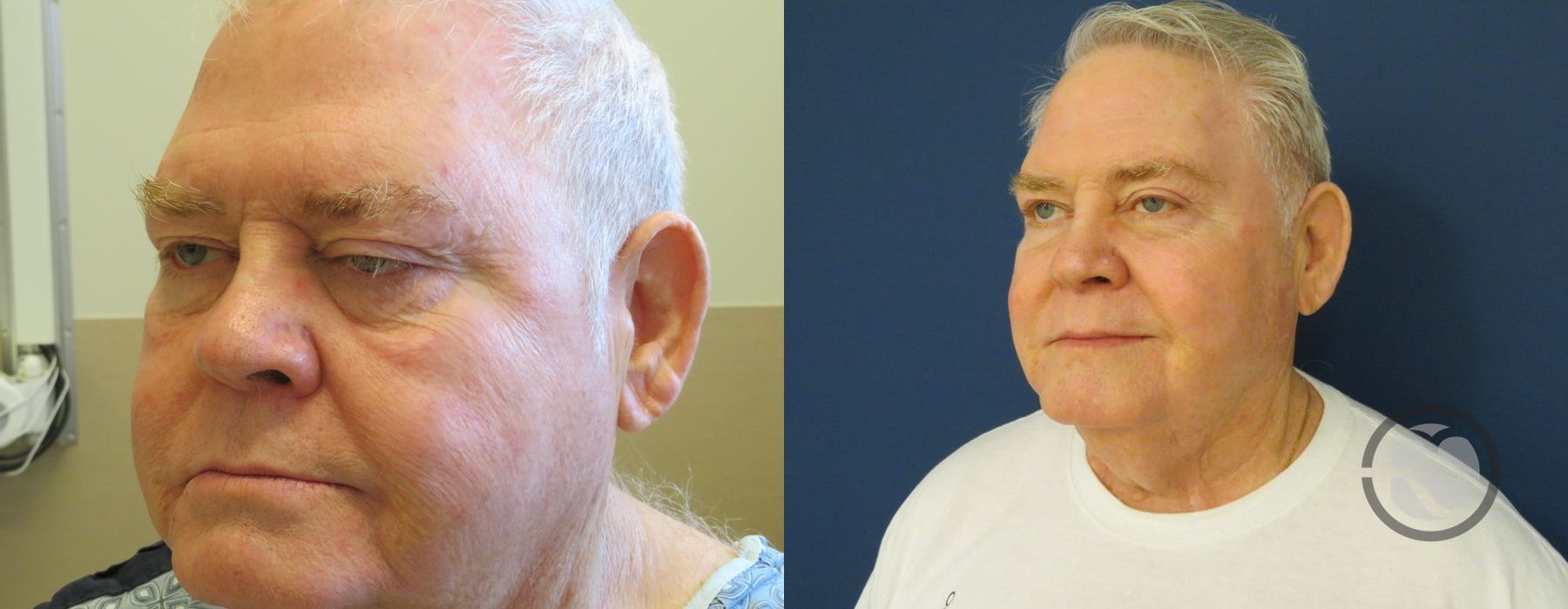 Before photo - Angle 4