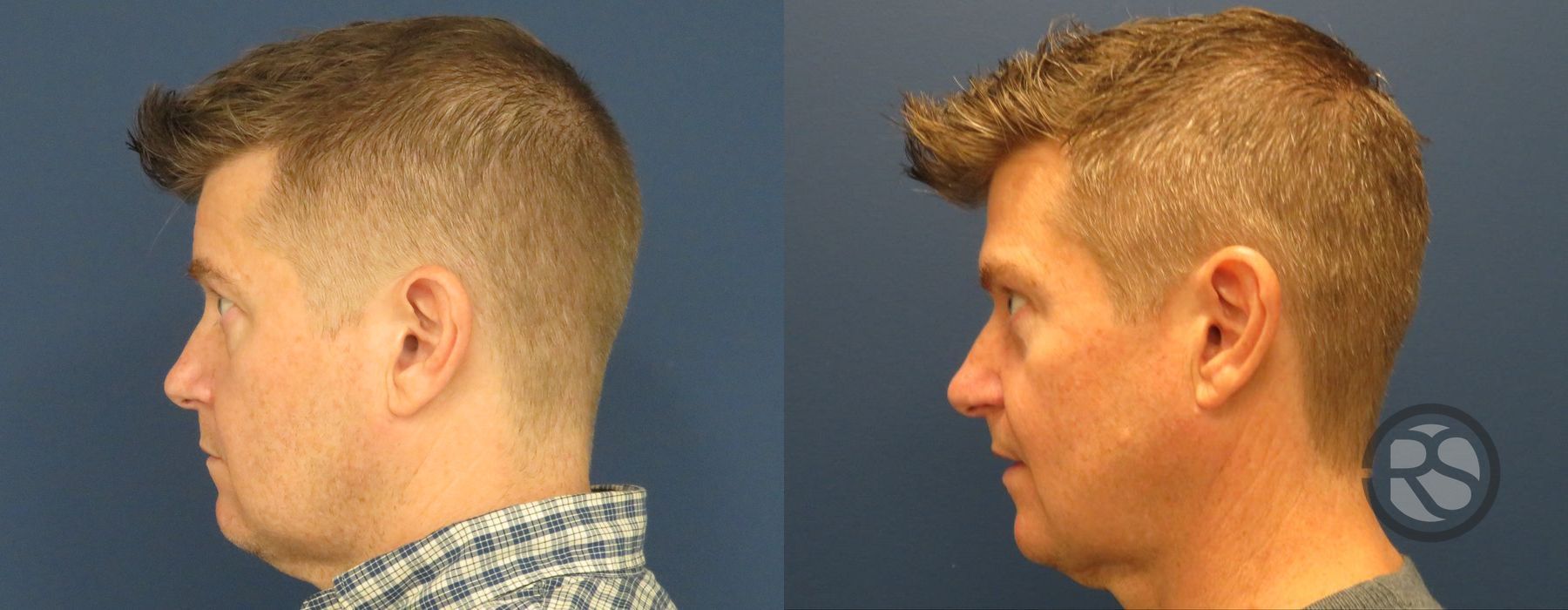 Before photo - Angle 5