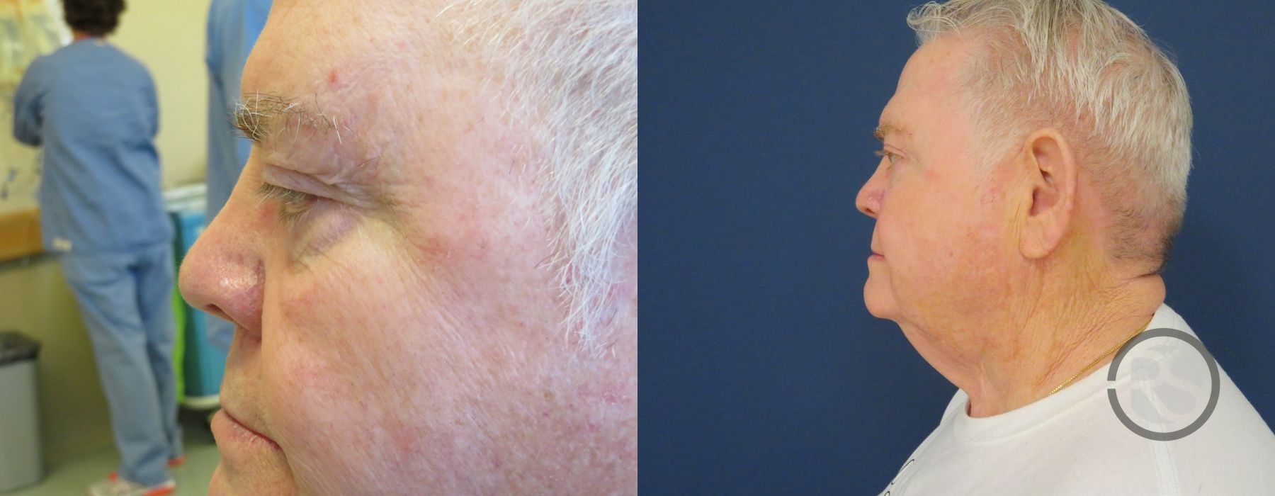 Before photo - Angle 5