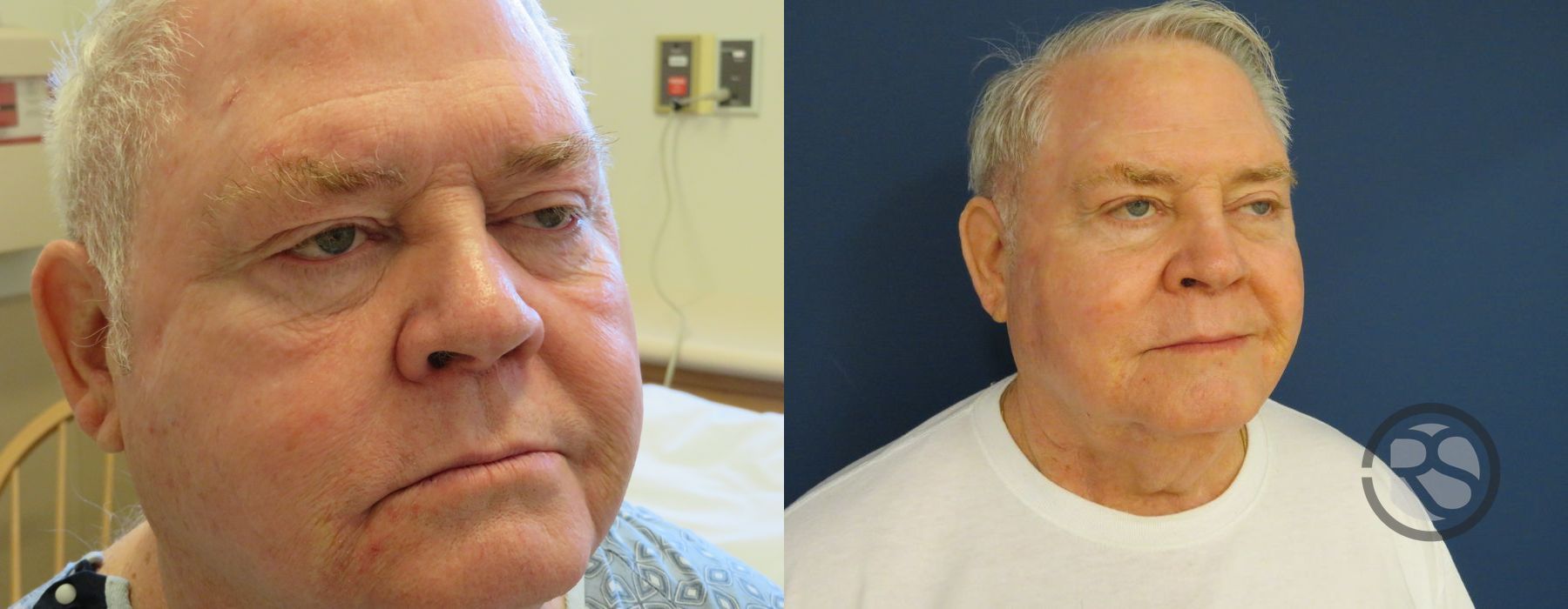 Before photo - Angle 2