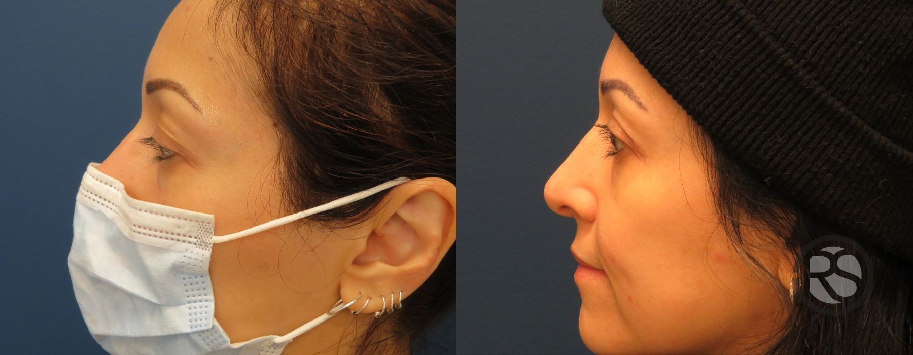 Before photo - Angle 5