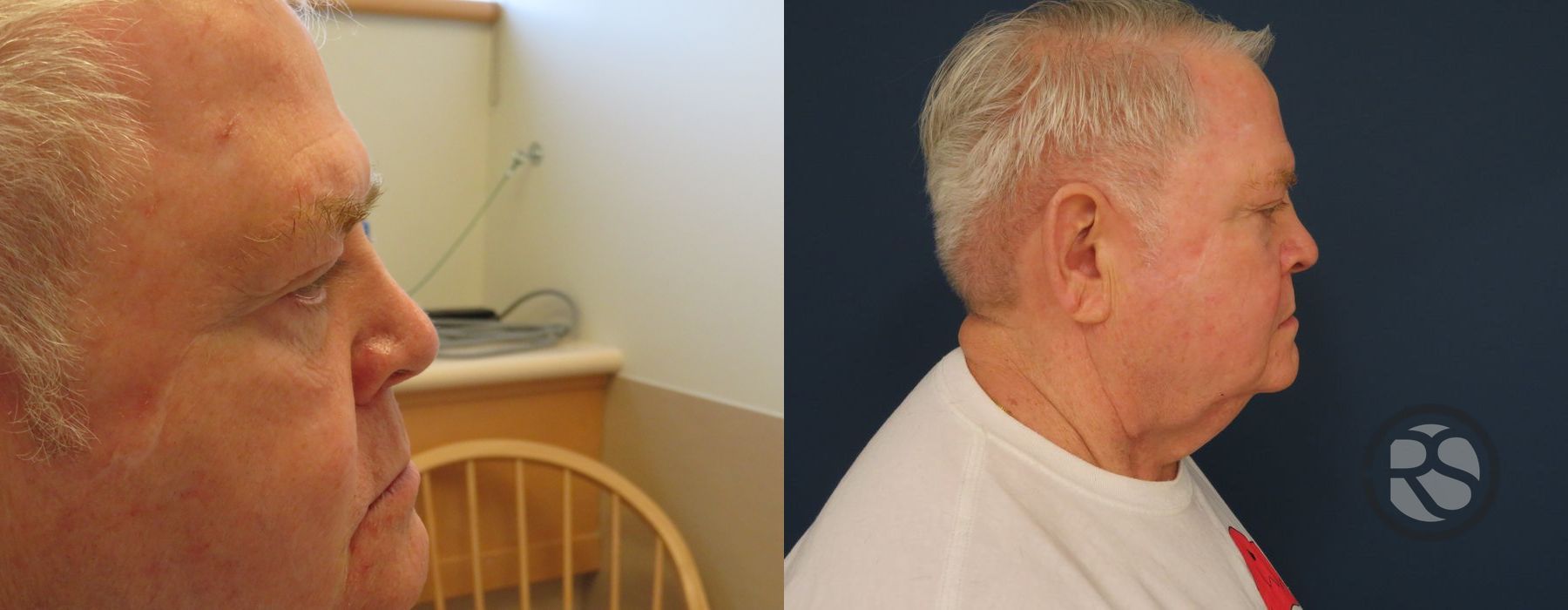 Before photo - Angle 3