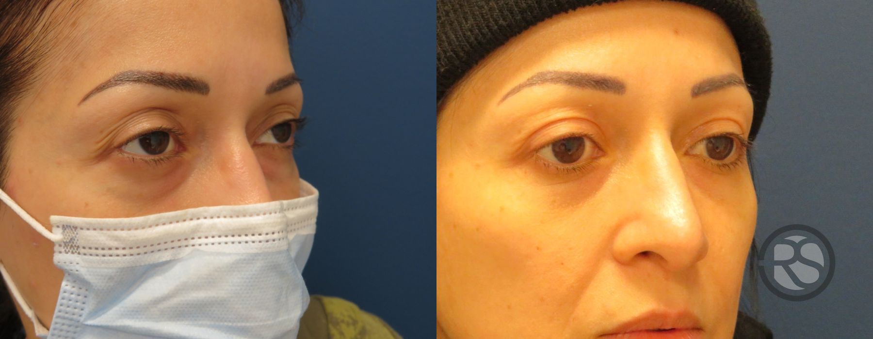 Before photo - Angle 2