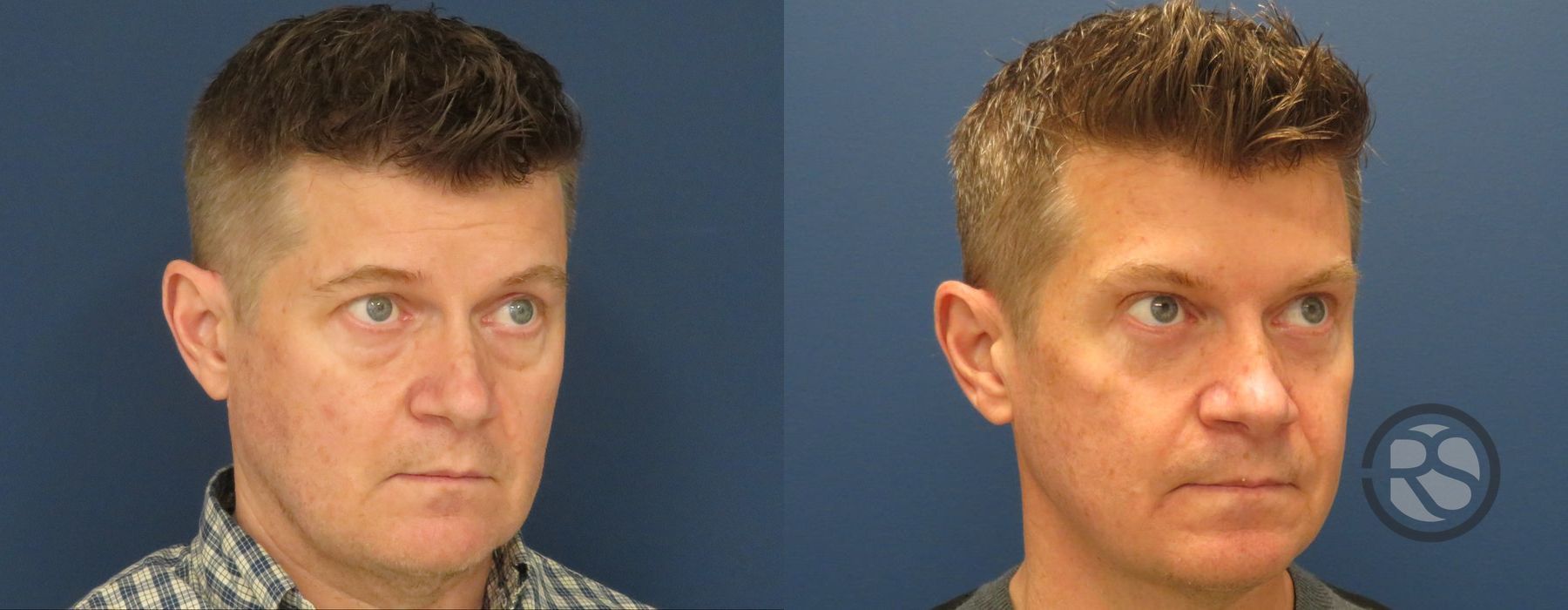 Before photo - Angle 2