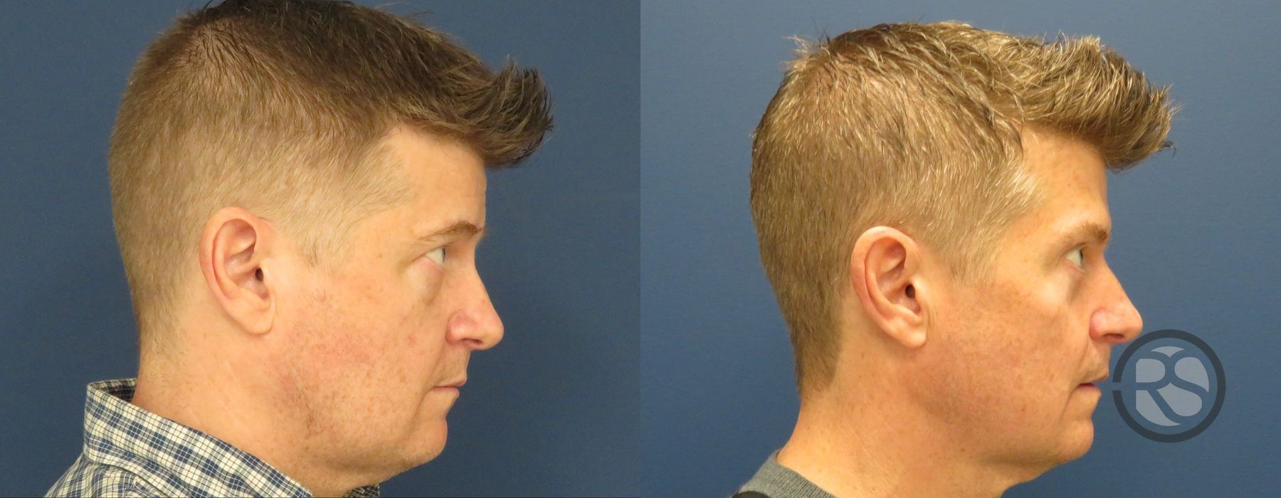 Before photo - Angle 3