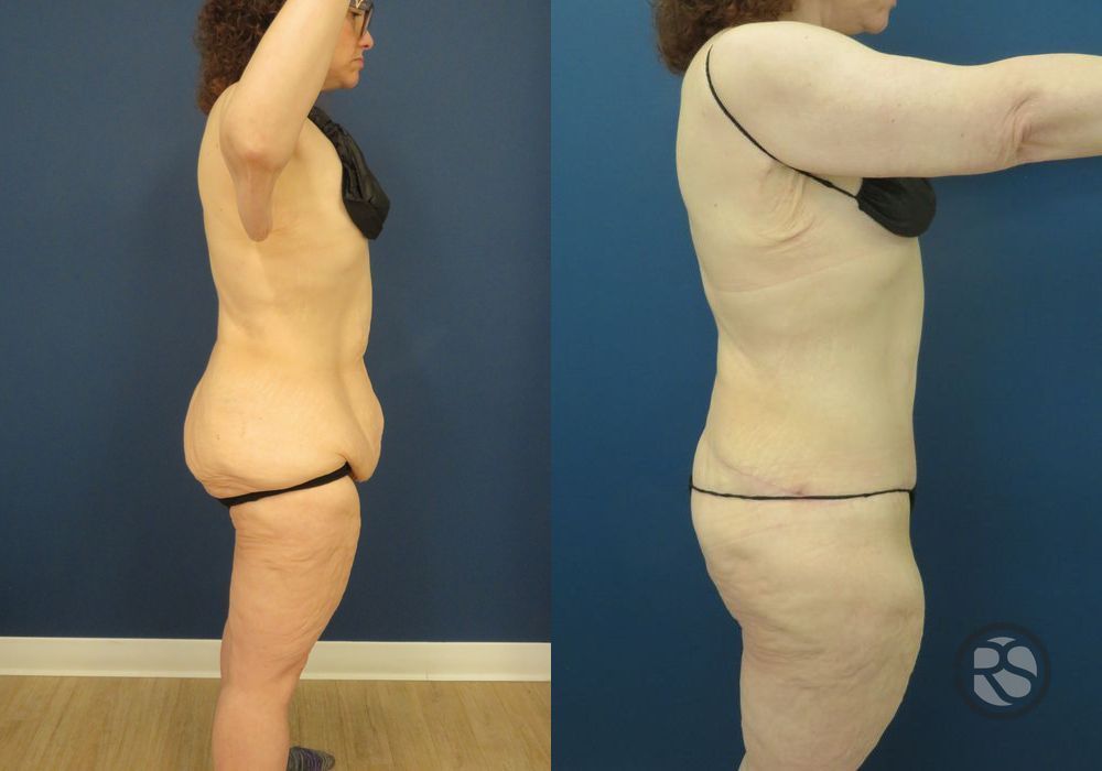 Before photo - Angle 3