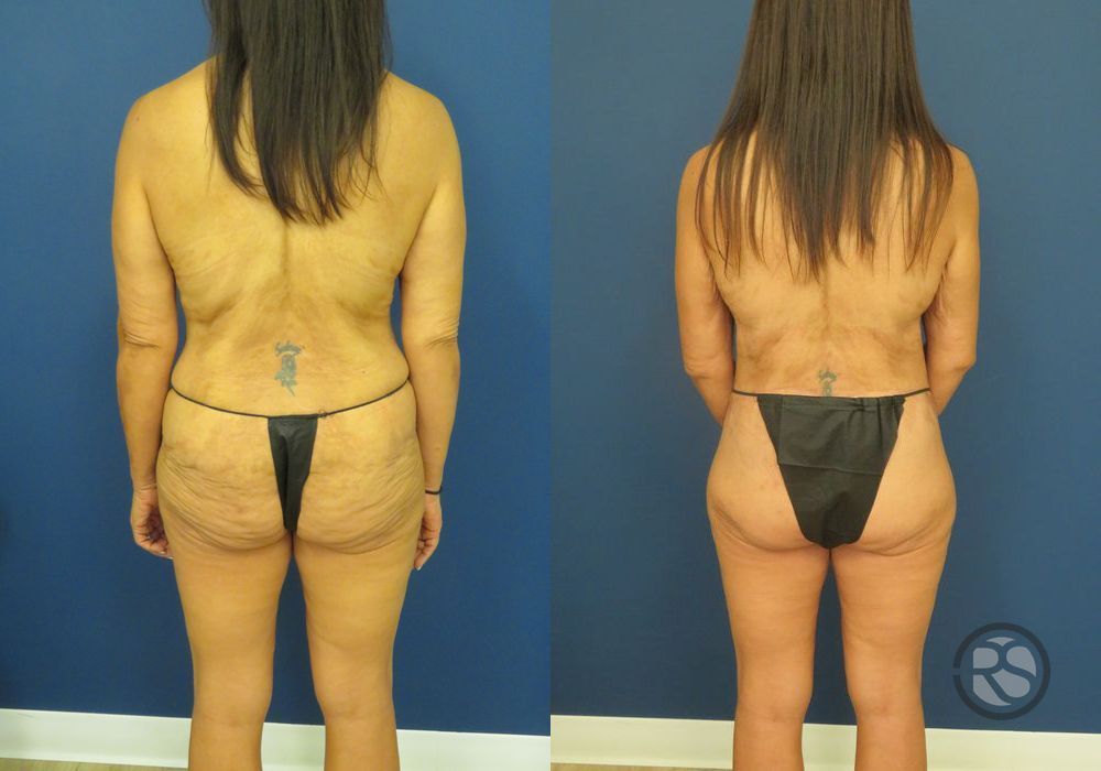 Before photo - Angle 6