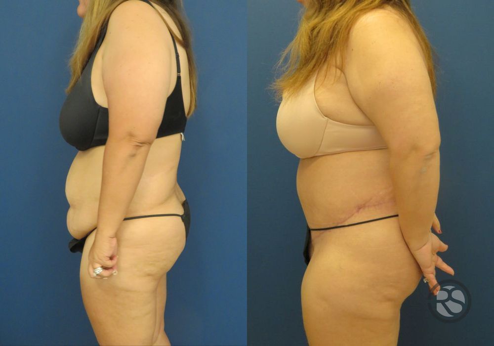 Before photo - Angle 5