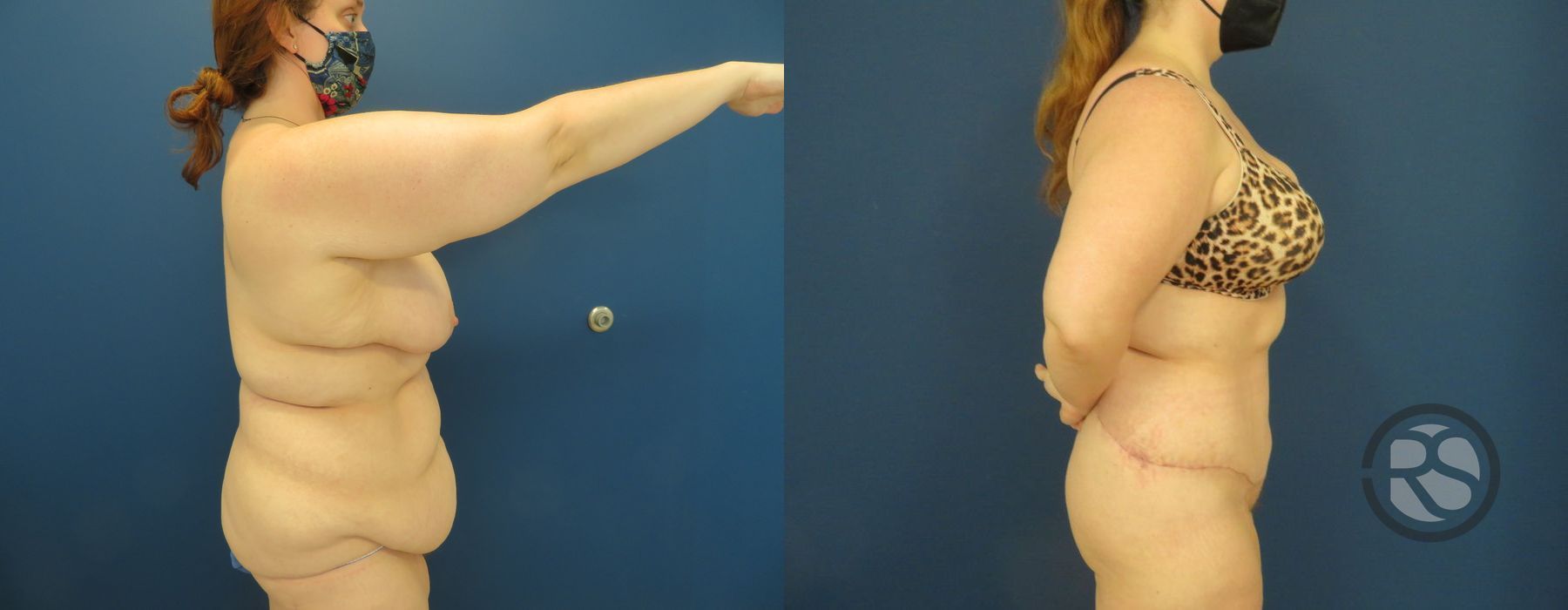 Before photo - Angle 3