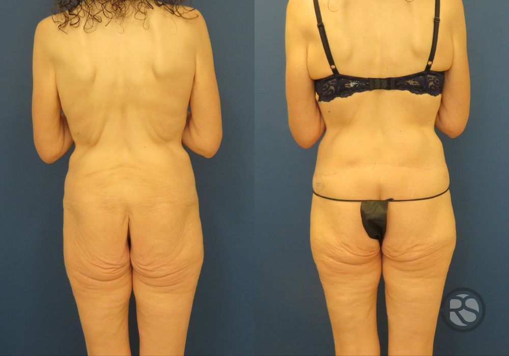 Before photo - Angle 6