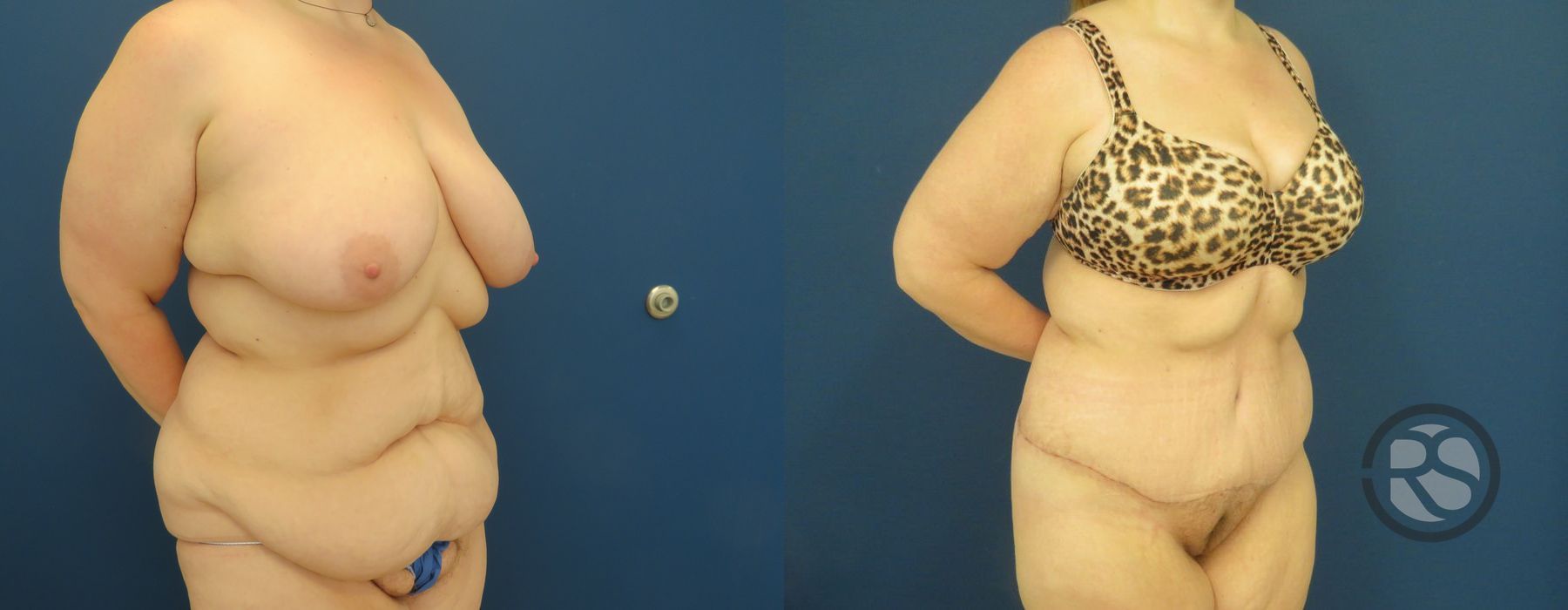 Before photo - Angle 2