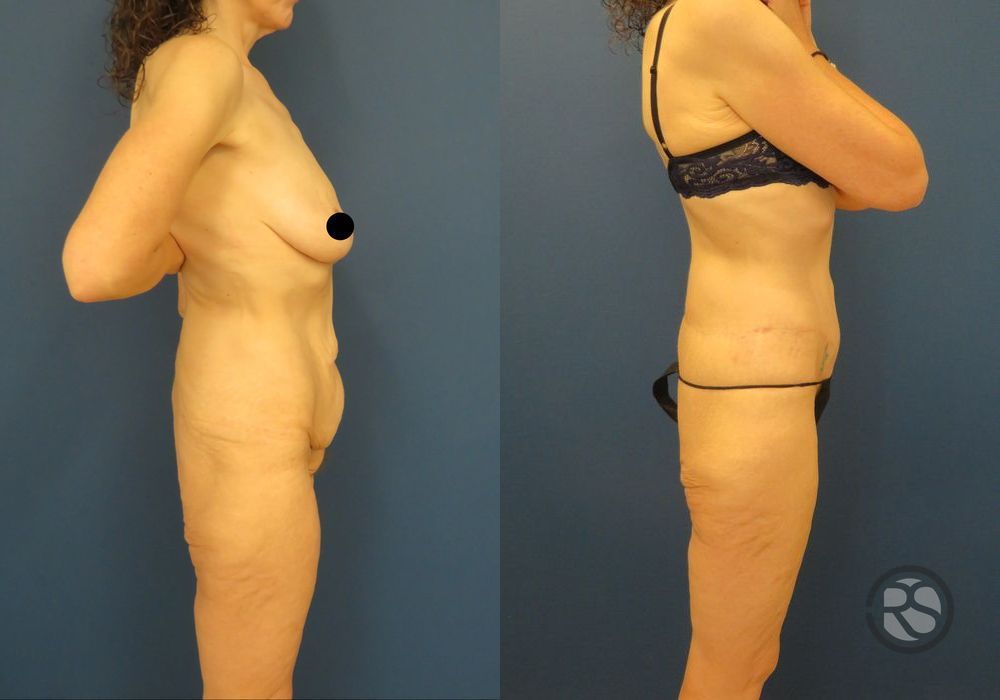 Before photo - Angle 3