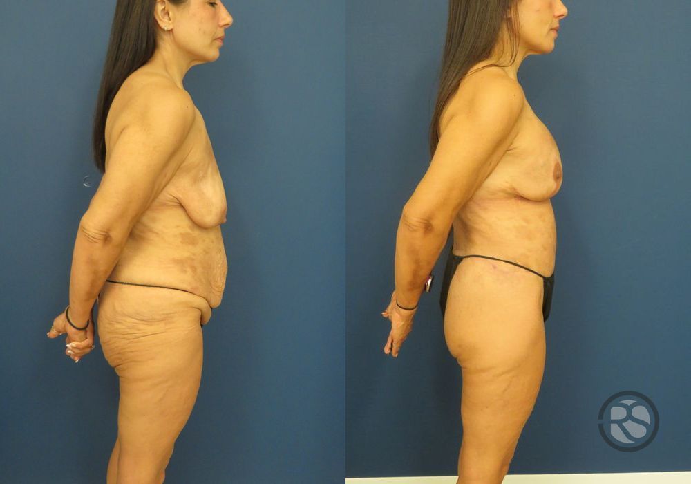 Before photo - Angle 2