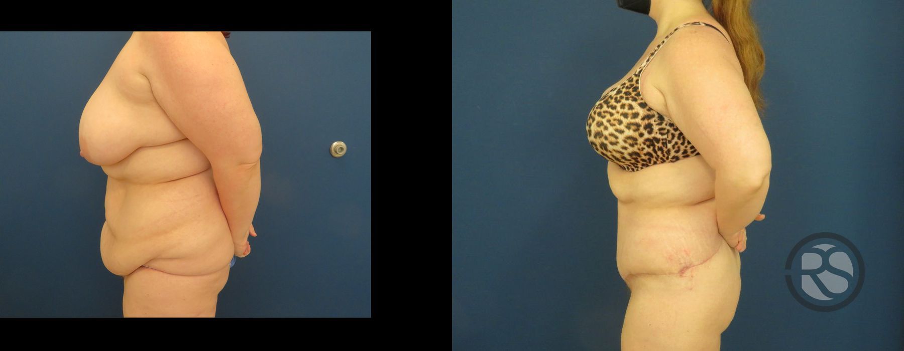 Before photo - Angle 5